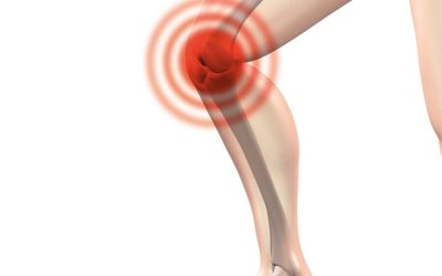 Ejercicio para el dolor de rodilla