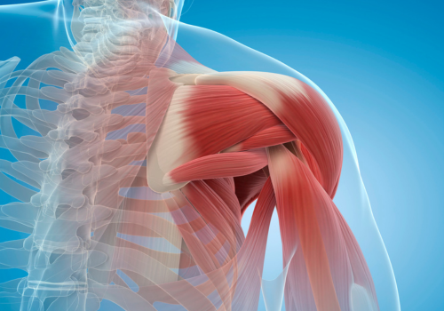 Beneficios de la fisioterapia para el dolor crónico